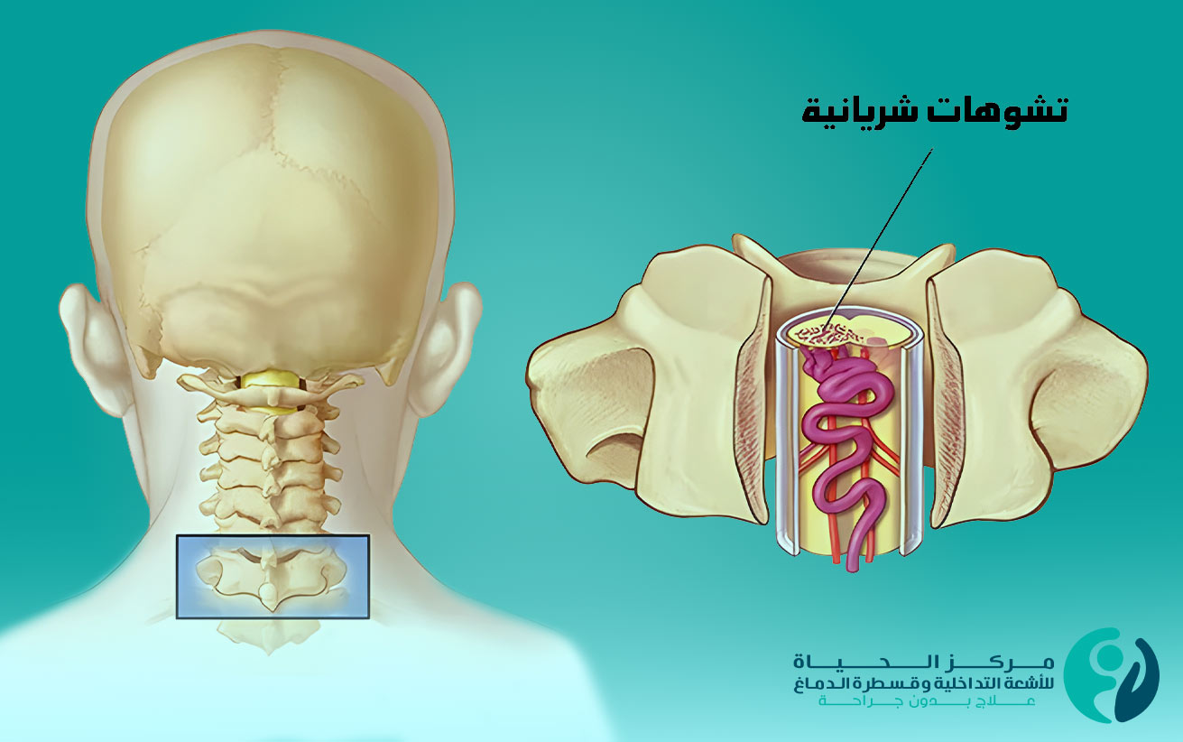 الحبل الشوكي