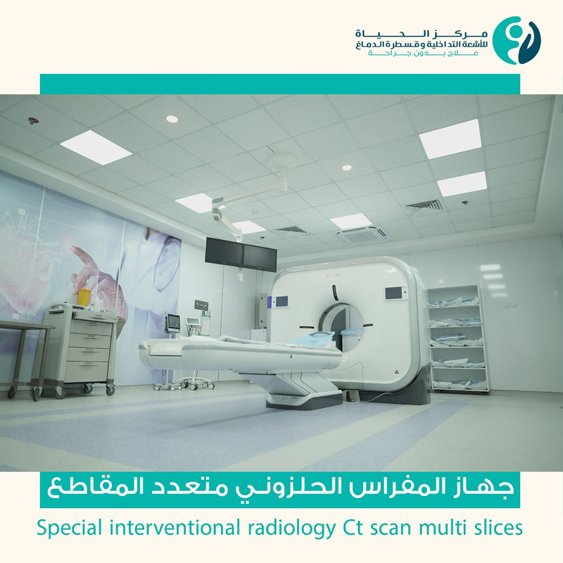  جهاز المفراس الحلزوني متعدد المقاطع Special Interventional Radiology CT scan multi slices