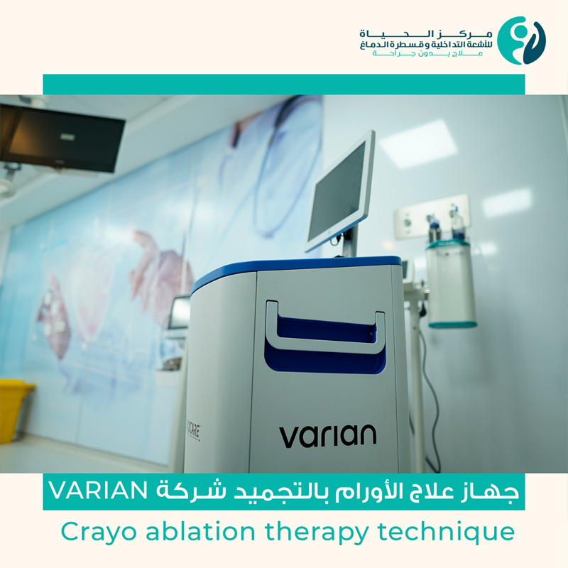 جهاز علاج الأورام بالتجميد شركة Varian (Cryo ablation therapy technique)