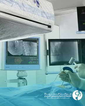 Interventional-Radiology-for-Tumors