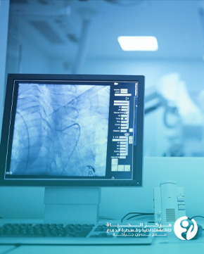 What-You-Don't-Know-About-Interventional-Radiology