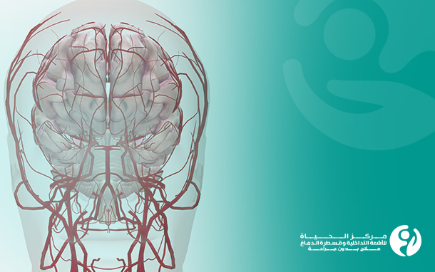 تضيق الشرايين والأوردة الدماغية